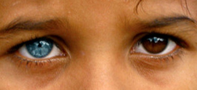 Колір очей у новонароджених: коли остаточно змінюється на постійний, в якому віці
