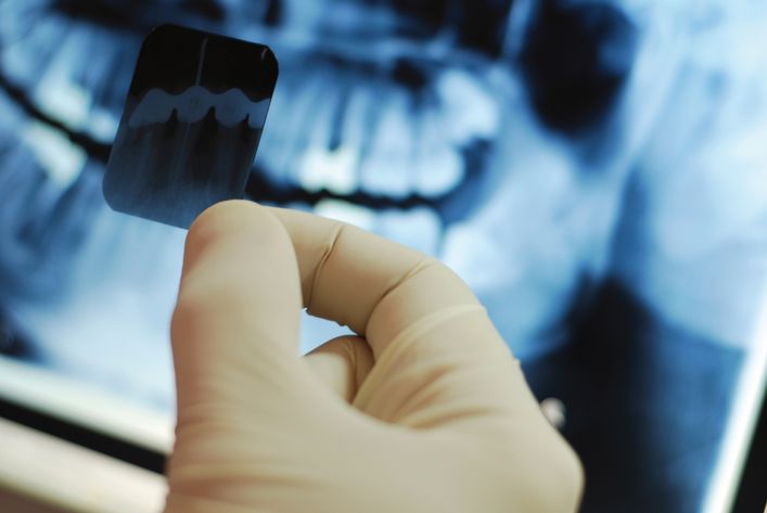 Лікування зубів при ГВ: чи можна проводити процедури і допускається анестезія