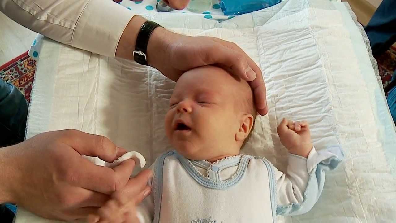 Масаж слізного каналу у новонароджених: як правильно робити фото