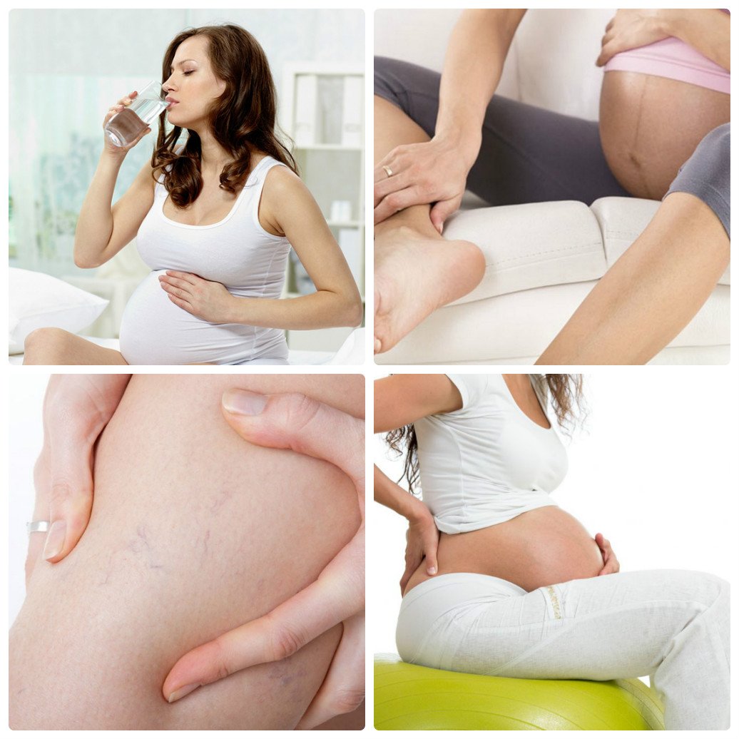 Пологи на 26 тижні вагітності, причини і наслідки