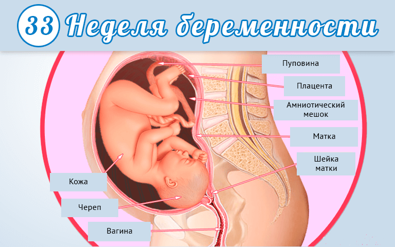 Пологи на 33 тижні вагітності: причини, симптоми, родовий процес, можливі наслідки, відгуки