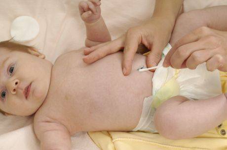 Догляд за пупковою ранкою новонародженого: правильний алгоритм і чим мазати