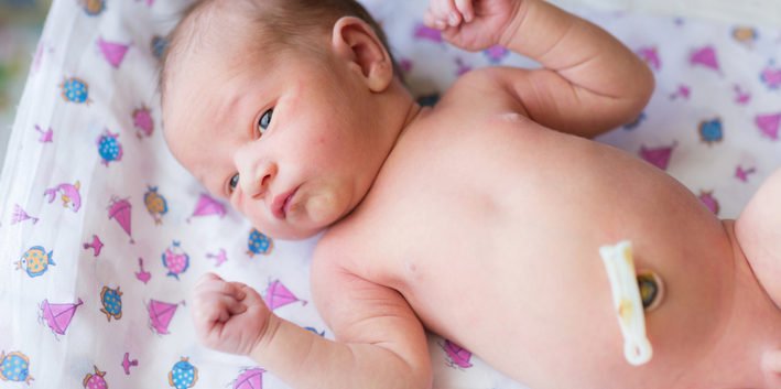 Догляд за пупковою ранкою новонародженого: правильний алгоритм і чим мазати