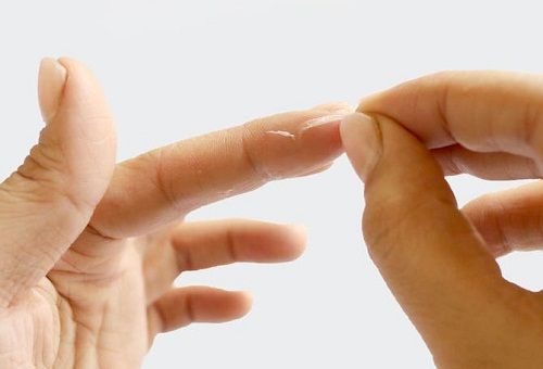 8 способів: чим прибрати суперклей, як очистити руки від суперклею, як позбавитися від суперклею на руках