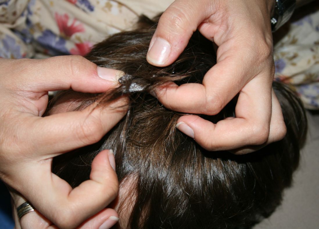 9 способів: як прибрати жуйку з волосся, як відліпити жуйку від волосся, як витягнути жуйку з волосся